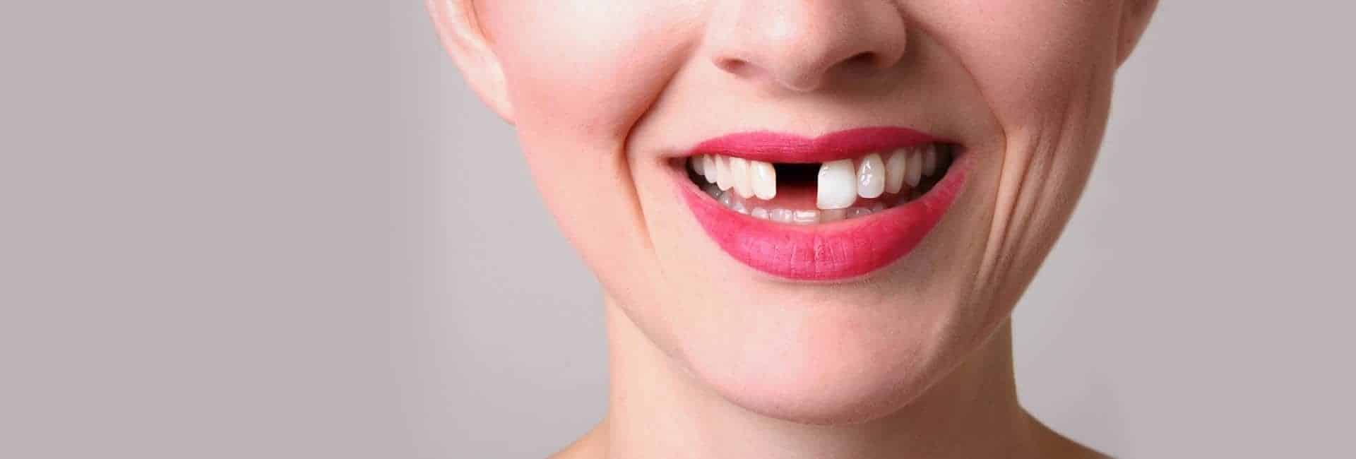 Diş Fırçalama Oranları Düşük: Neden, Nasıl Ve Ne Kadar Diş Sağlığımıza Dikkat Etmeliyiz?