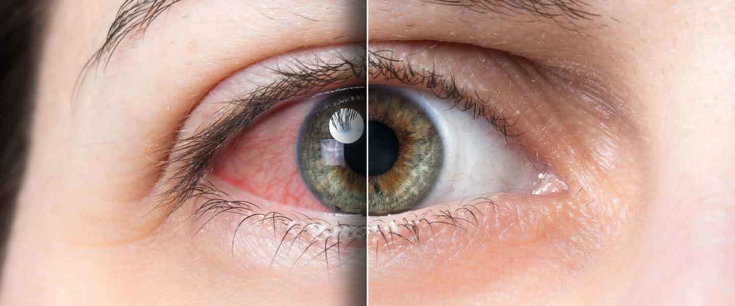 İnsanların Neden Farklı Göz Şekilleri Var?