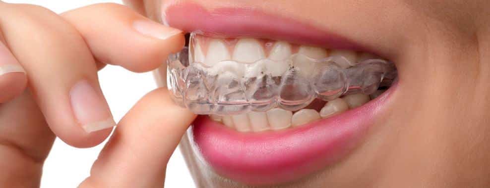 Bruksizm Nedir, Neden Olur? – Diş Sıkmanın En İyi Tedavisi