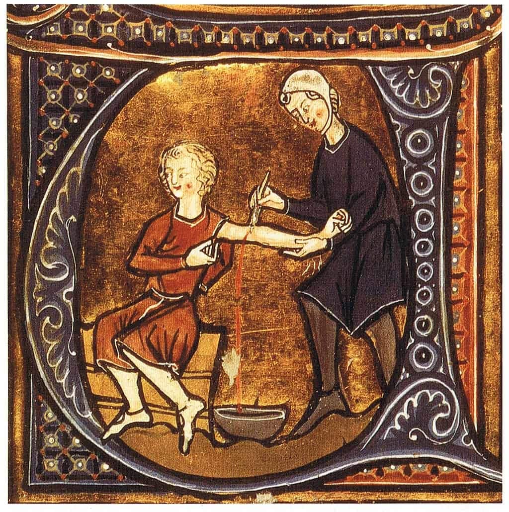 Ortaçağ’da Akıl Almaz Acı Verici Tedavi Yöntemleri