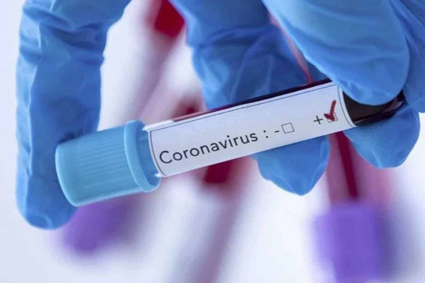 Corona Virüsü Nedir – Nasıl Bulaşıyor – Corona Virüs Hakkında Bilmek İsteyeceğiniz Her Şey!