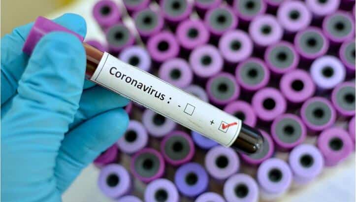 Temizlik Ürünlerinin COVID-19’a Karşı Etkileri Hakkında Yanlış Bilinenler – Corona Virüs Hakkında Merak Edilen Her Şey!