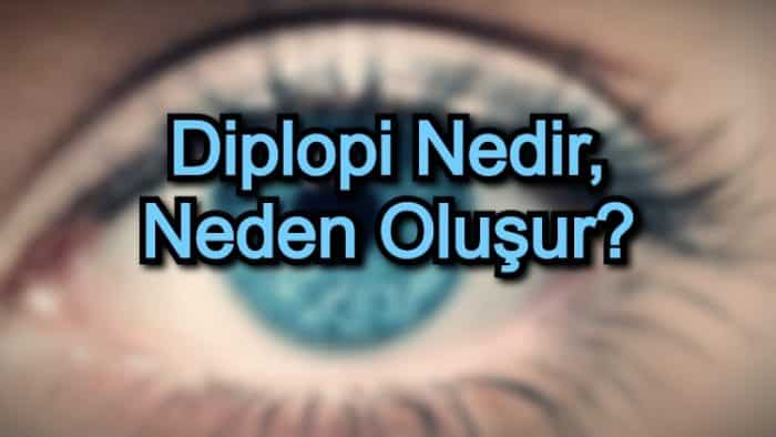 Diplopi Nedir, Neden Oluşur?